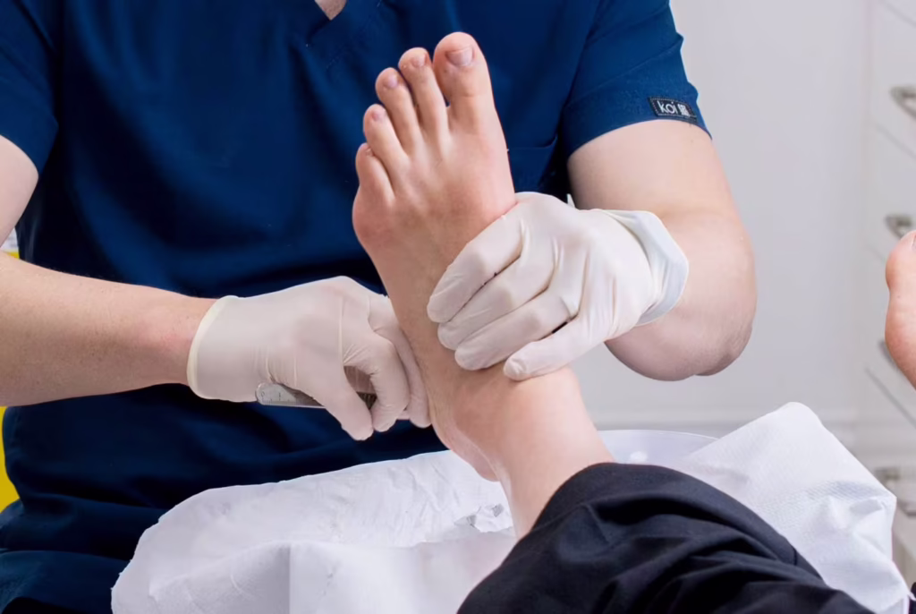 flat feet