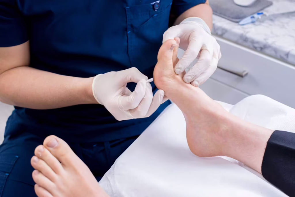 verruca needling